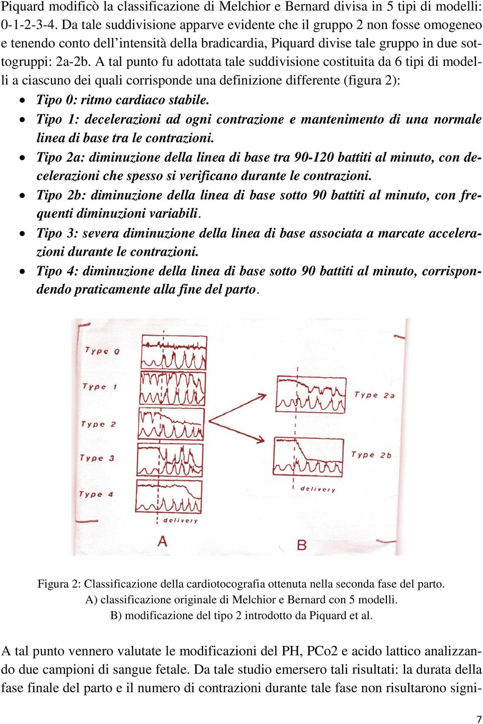 A tal punto fu adottata tale suddivisione costituita da 6 tipi di modelli a ciascuno dei quali corrisponde una definizione differente (figura 2): Tipo 0: ritmo cardiaco stabile.