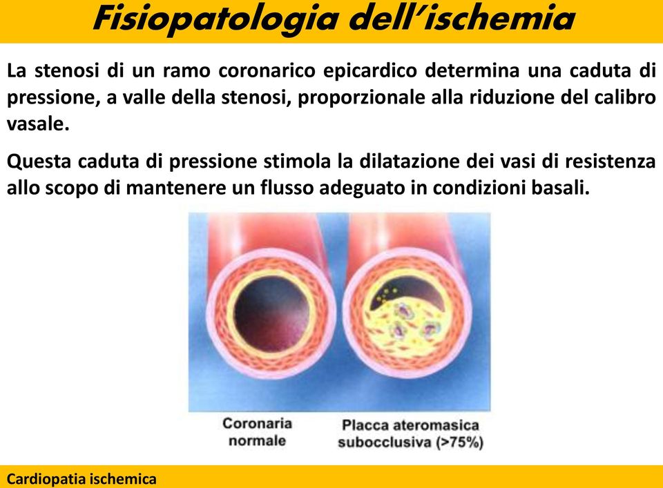 alla riduzione del calibro vasale.