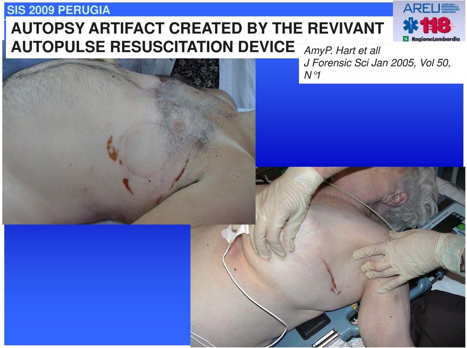 RESUSCITATION DEVICE AmyP.