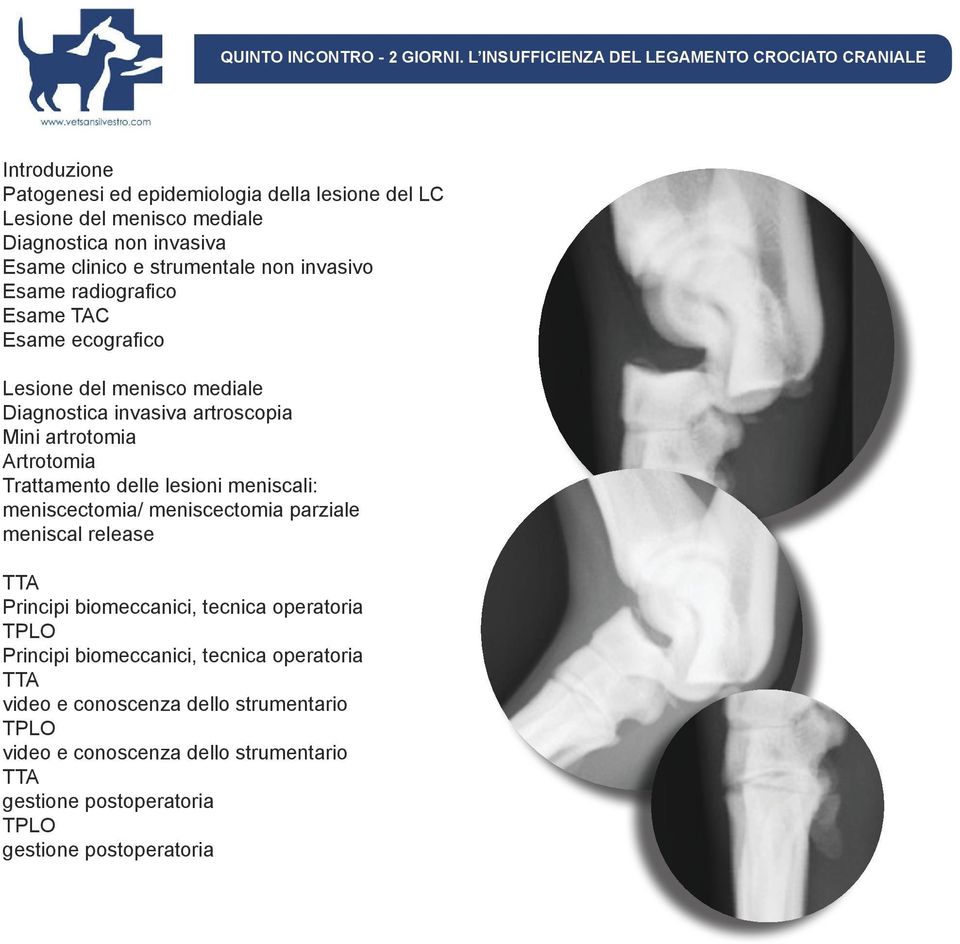 clinico e strumentale non invasivo Esame radiografico Esame TAC Esame ecografico Lesione del menisco mediale Diagnostica invasiva artroscopia Mini artrotomia Artrotomia