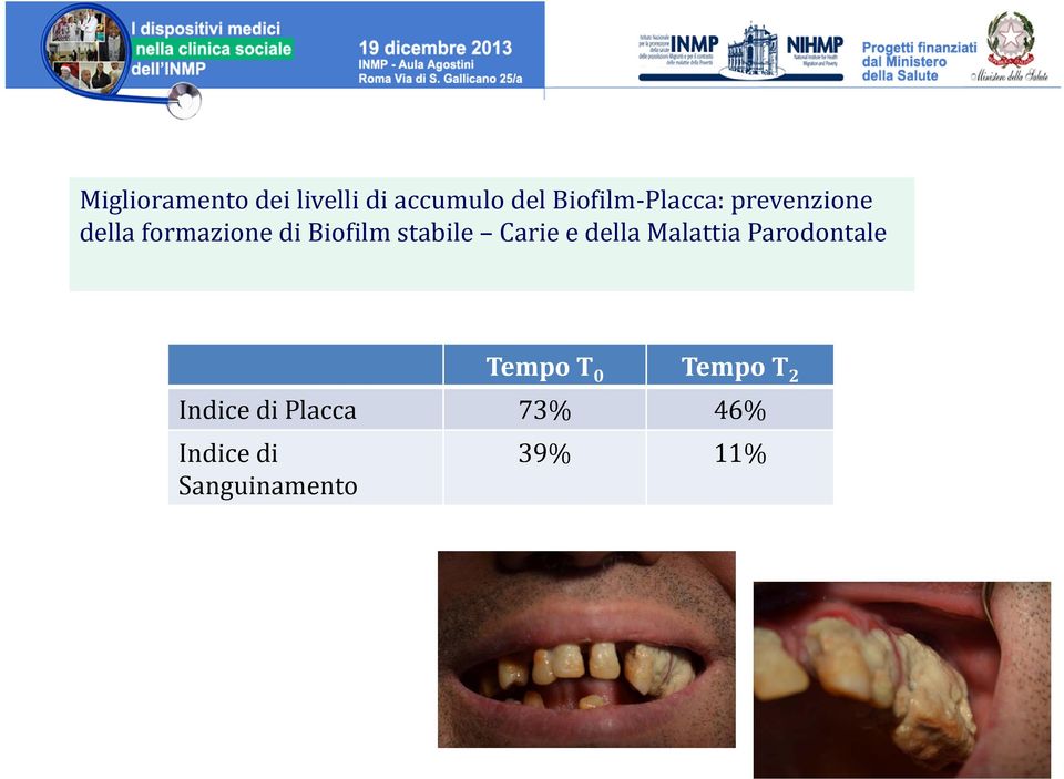 stabile Carie e della Malattia Parodontale Tempo T 0