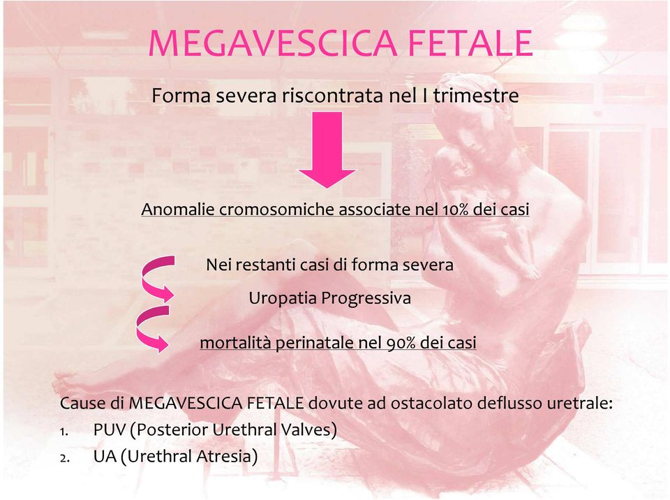 mortalità perinatale nel 90% dei casi Cause di MEGAVESCICA FETALE dovute ad