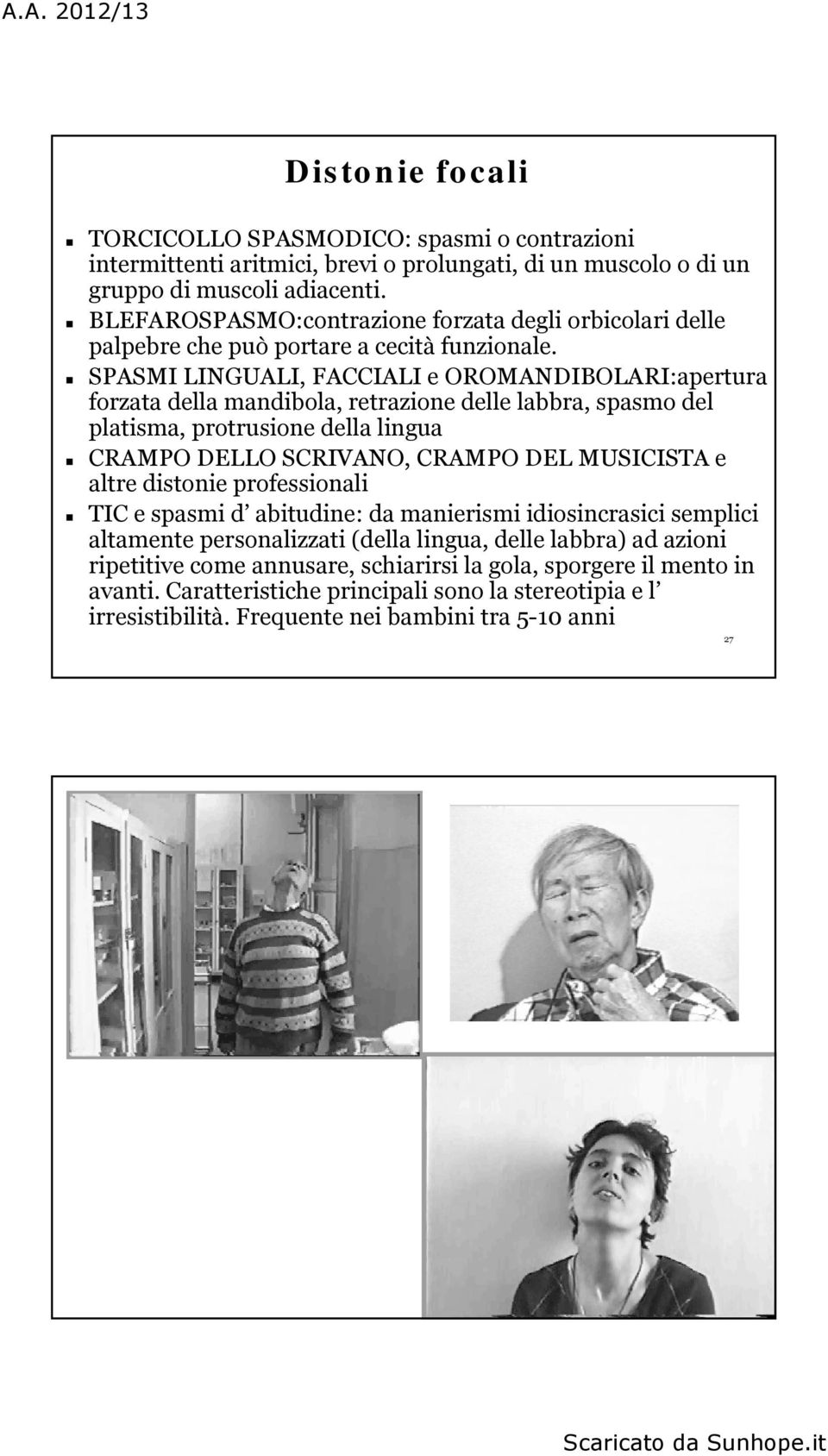 SPASMI LINGUALI, FACCIALI e OROMANDIBOLARI:apertura forzata della mandibola, retrazione delle labbra, spasmo del platisma, protrusione della lingua CRAMPO DELLO SCRIVANO, CRAMPO DEL MUSICISTA e