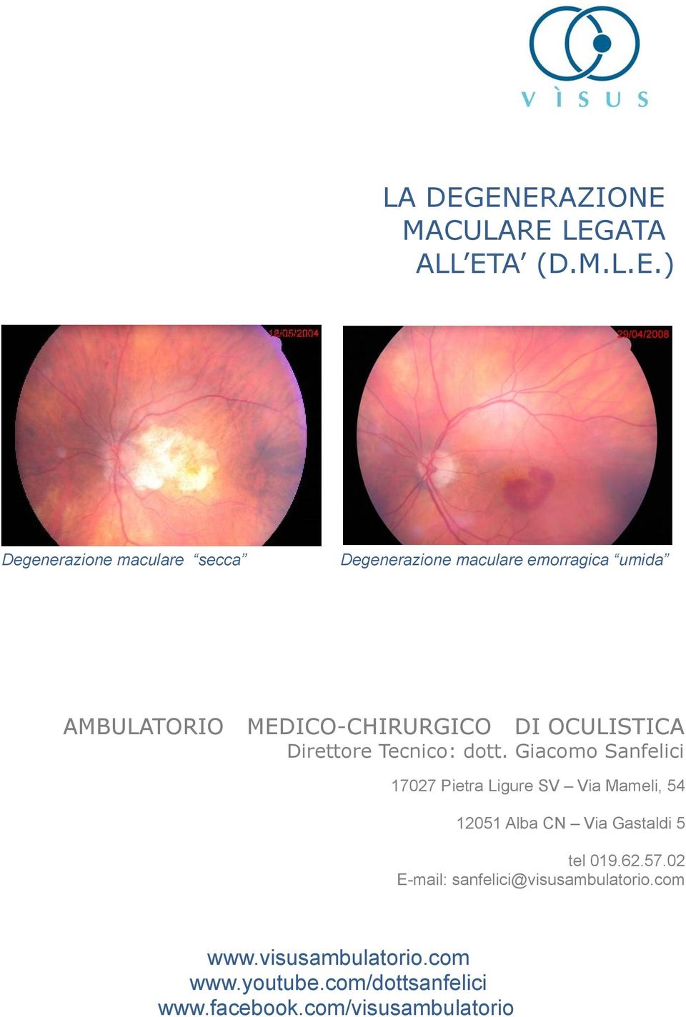 emorragica umida AMBULATORIO MEDICO-CHIRURGICO DI OCULISTICA Direttore Tecnico: dott.