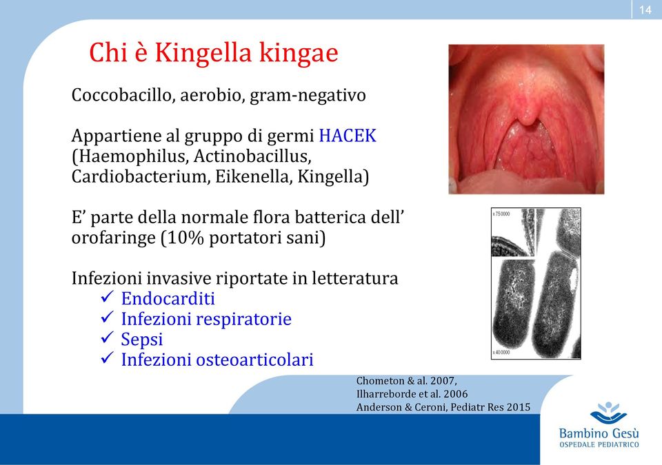 dell orofaringe (10% portatori sani) Infezioni invasive riportate in letteratura Endocarditi Infezioni