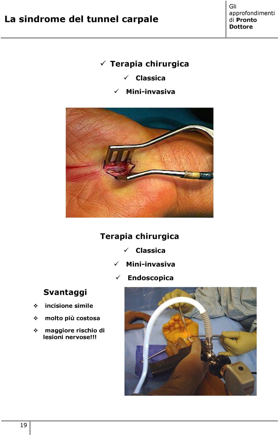 più costosa maggiore rischio di lesioni