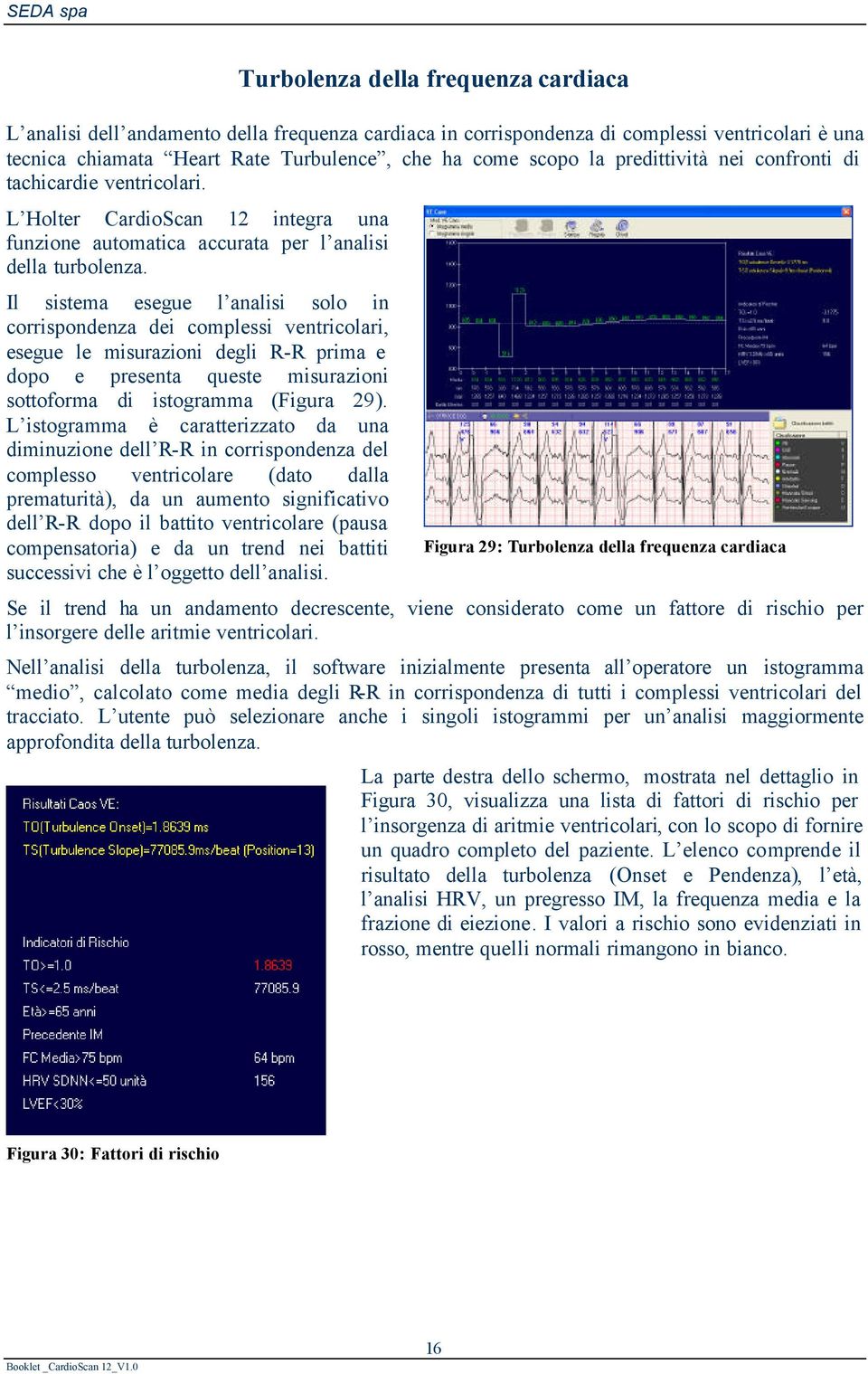 Il sistema esegue l analisi solo in corrispondenza dei complessi ventricolari, esegue le misurazioni degli R-R prima e dopo e presenta queste misurazioni sottoforma di istogramma (Figura 29).