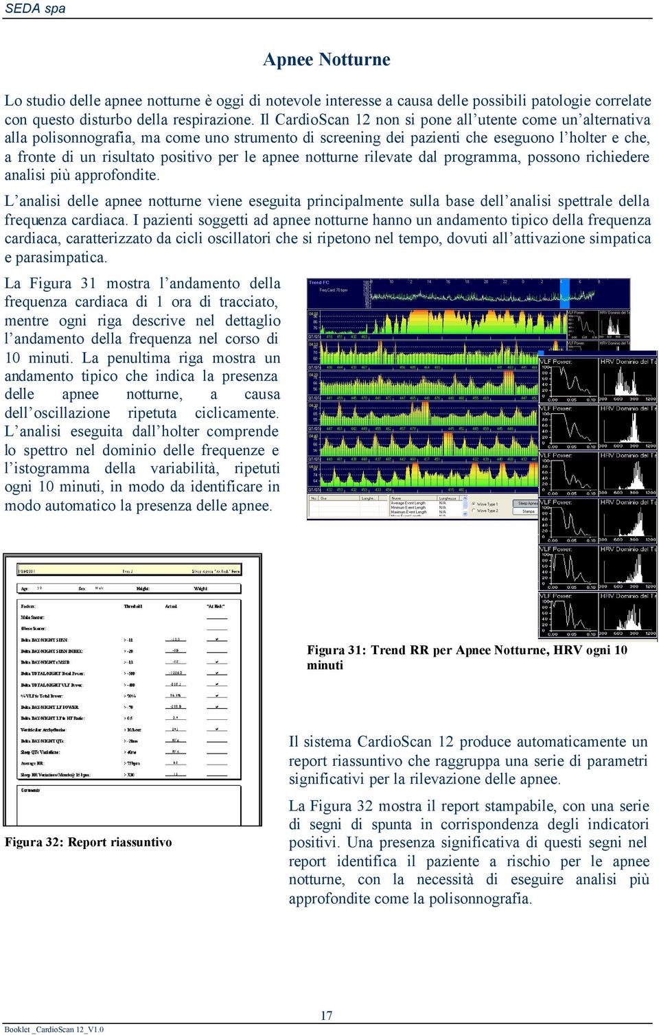 apnee notturne rilevate dal programma, possono richiedere analisi più approfondite.