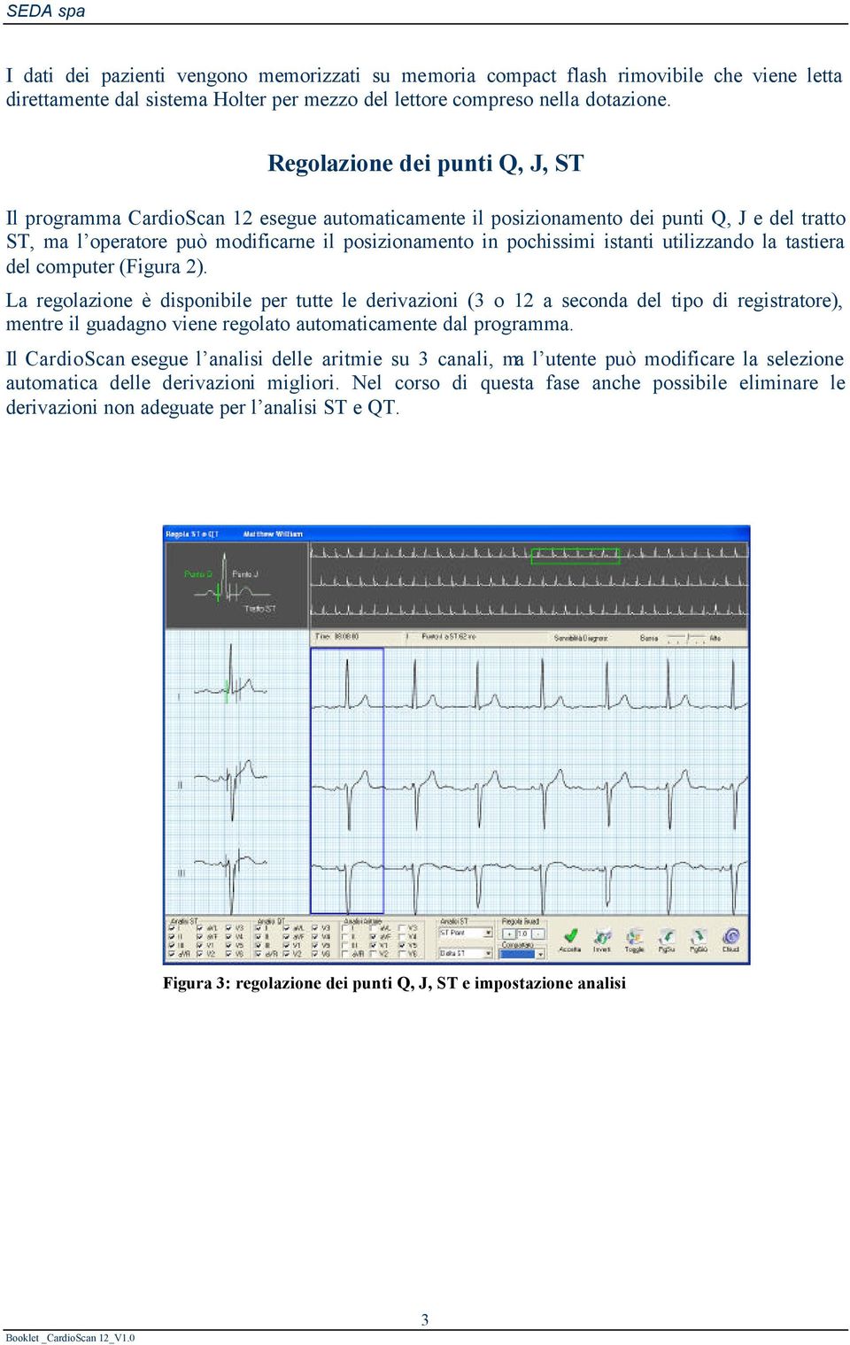 istanti utilizzando la tastiera del computer (Figura 2).