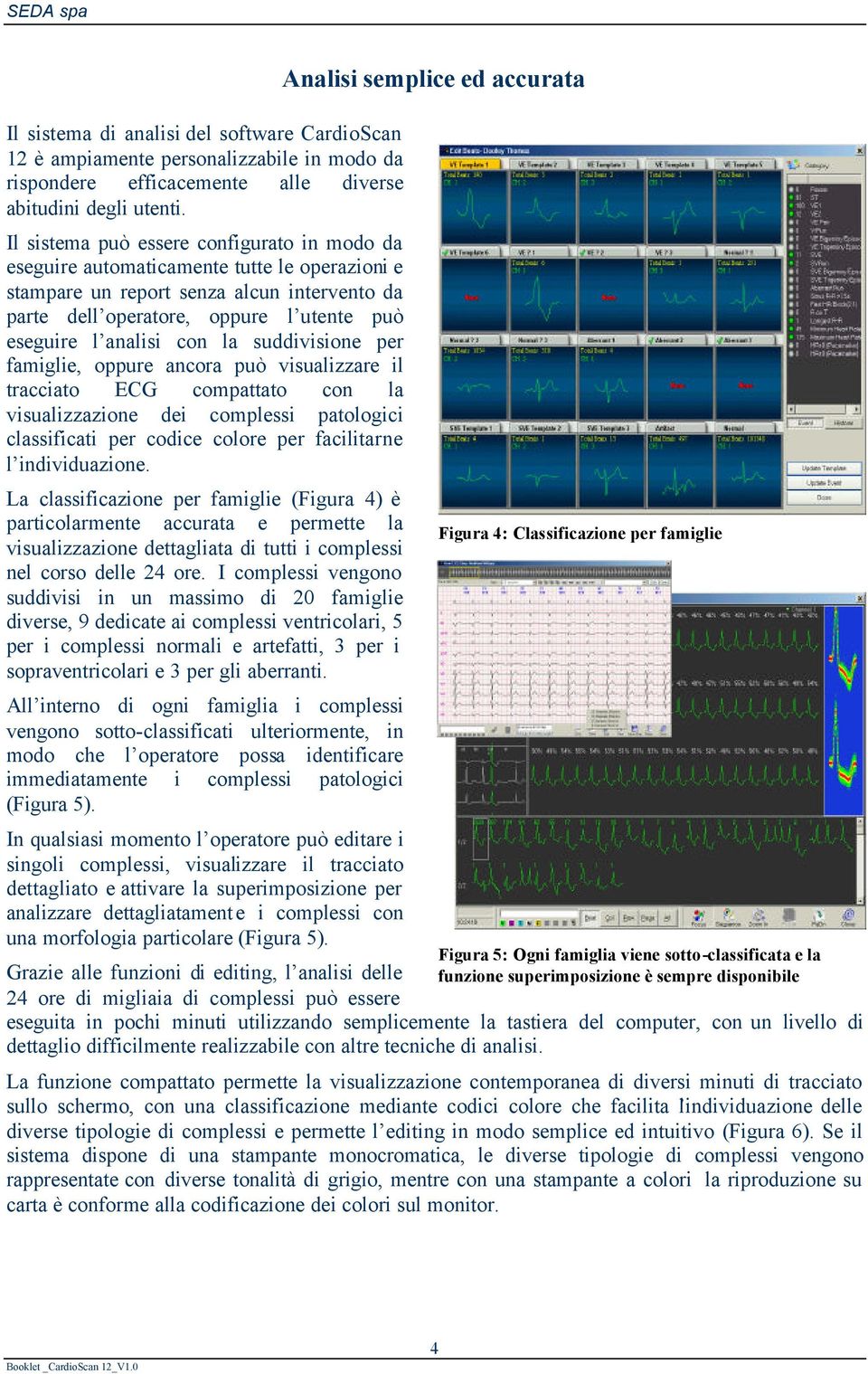 con la suddivisione per famiglie, oppure ancora può visualizzare il tracciato ECG compattato con la visualizzazione dei complessi patologici classificati per codice colore per facilitarne l