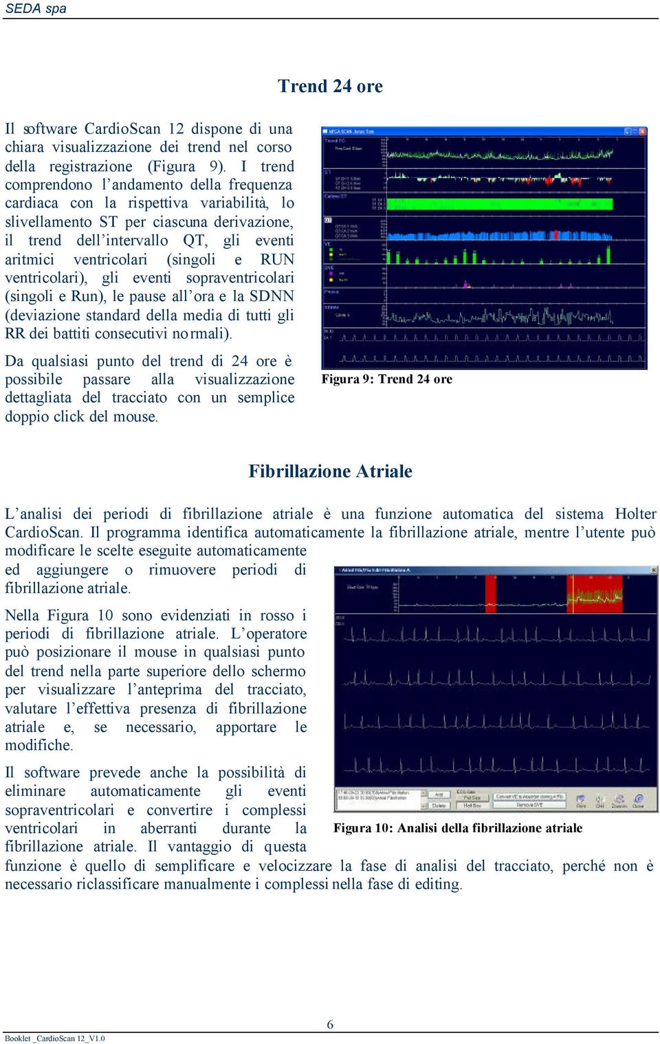 (singoli e RUN ventricolari), gli eventi sopraventricolari (singoli e Run), le pause all ora e la SDNN (deviazione standard della media di tutti gli RR dei battiti consecutivi normali).