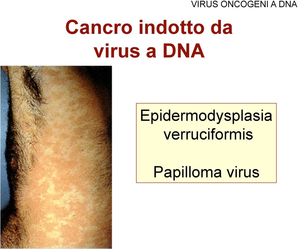 DNA Epidermodysplasia