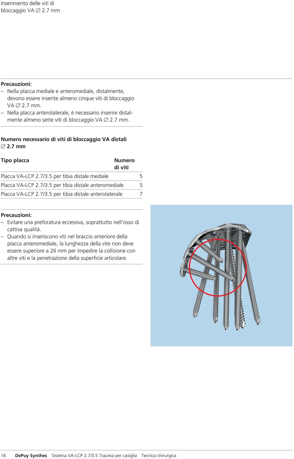 7/3.5 per tibia distale anterolaterale 7 Precauzioni: Evitare una preforatura eccessiva, soprattutto nell osso di cattiva qualità.