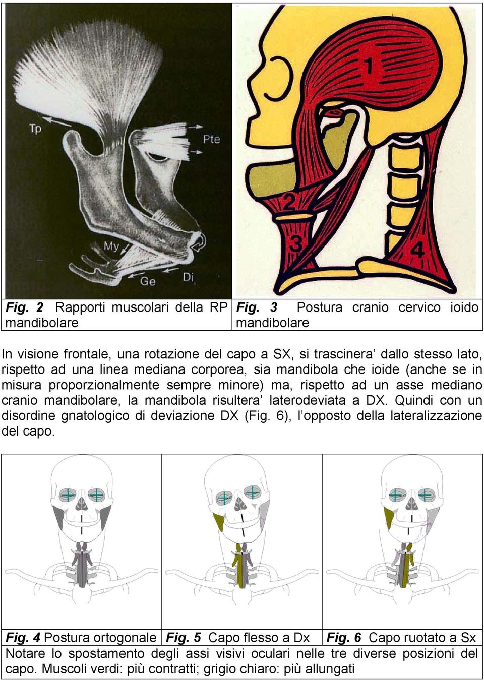 mandibola che ioide (anche se in misura proporzionalmente sempre minore) ma, rispetto ad un asse mediano cranio mandibolare, la mandibola risultera laterodeviata a DX.