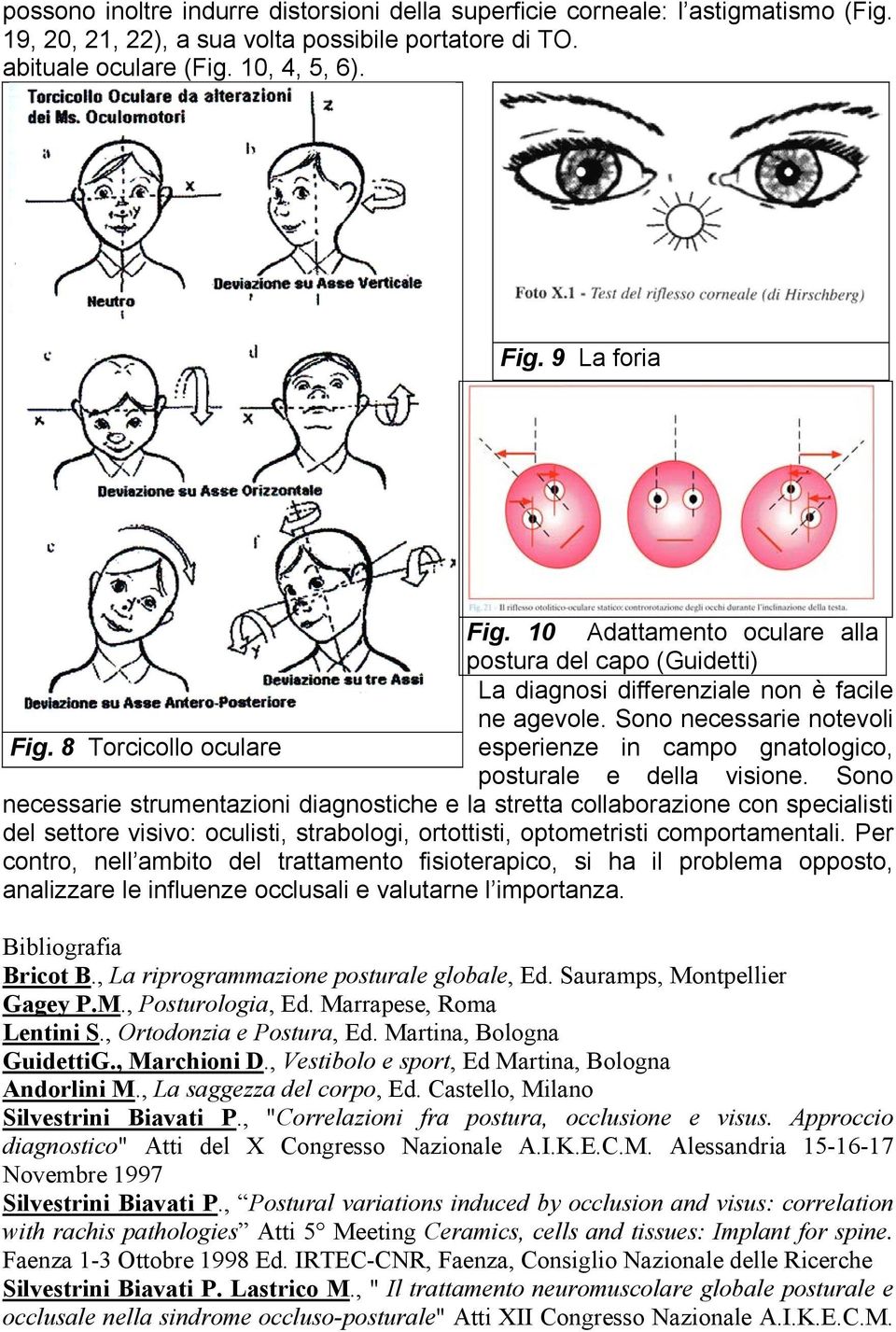 8 Torcicollo oculare esperienze in campo gnatologico, posturale e della visione.