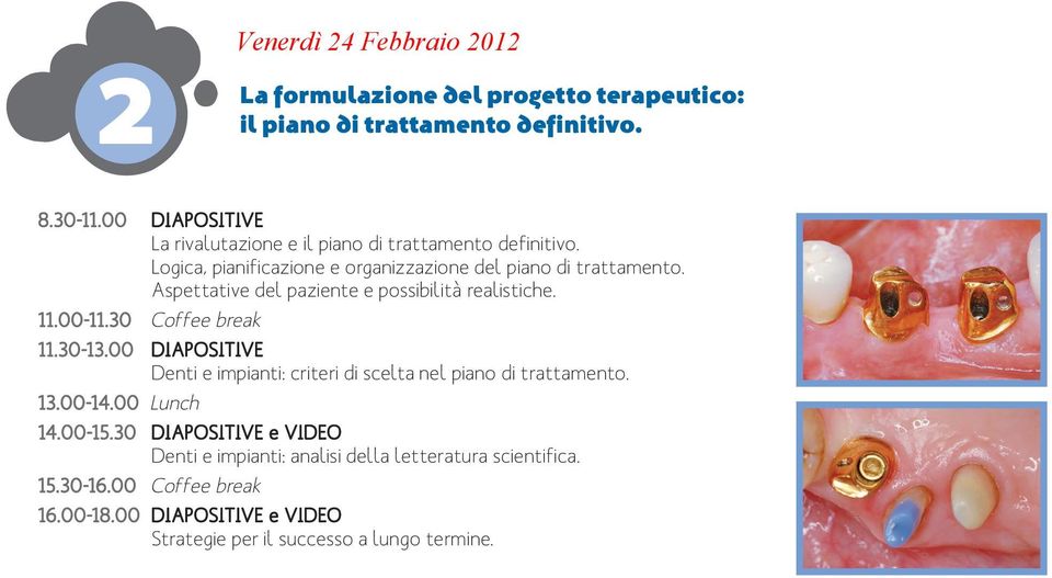 Aspettative del paziente e possibilità realistiche. 11.30-13.00 DIAPOSITIVE Denti e impianti: criteri di scelta nel piano di trattamento.