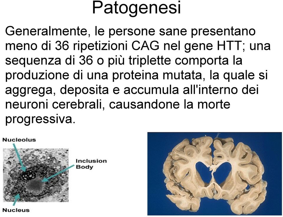 comporta la produzione di una proteina mutata, la quale si aggrega,