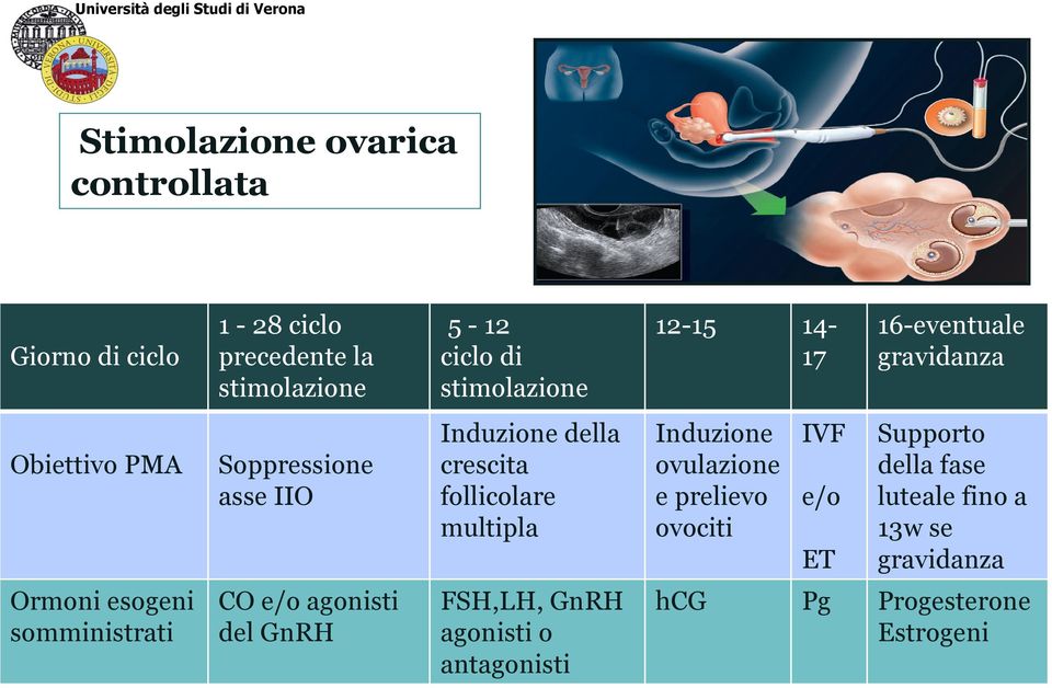 multipla Induzione ovulazione e prelievo ovociti IVF e/o ET Supporto della fase luteale fino a 13w se gravidanza