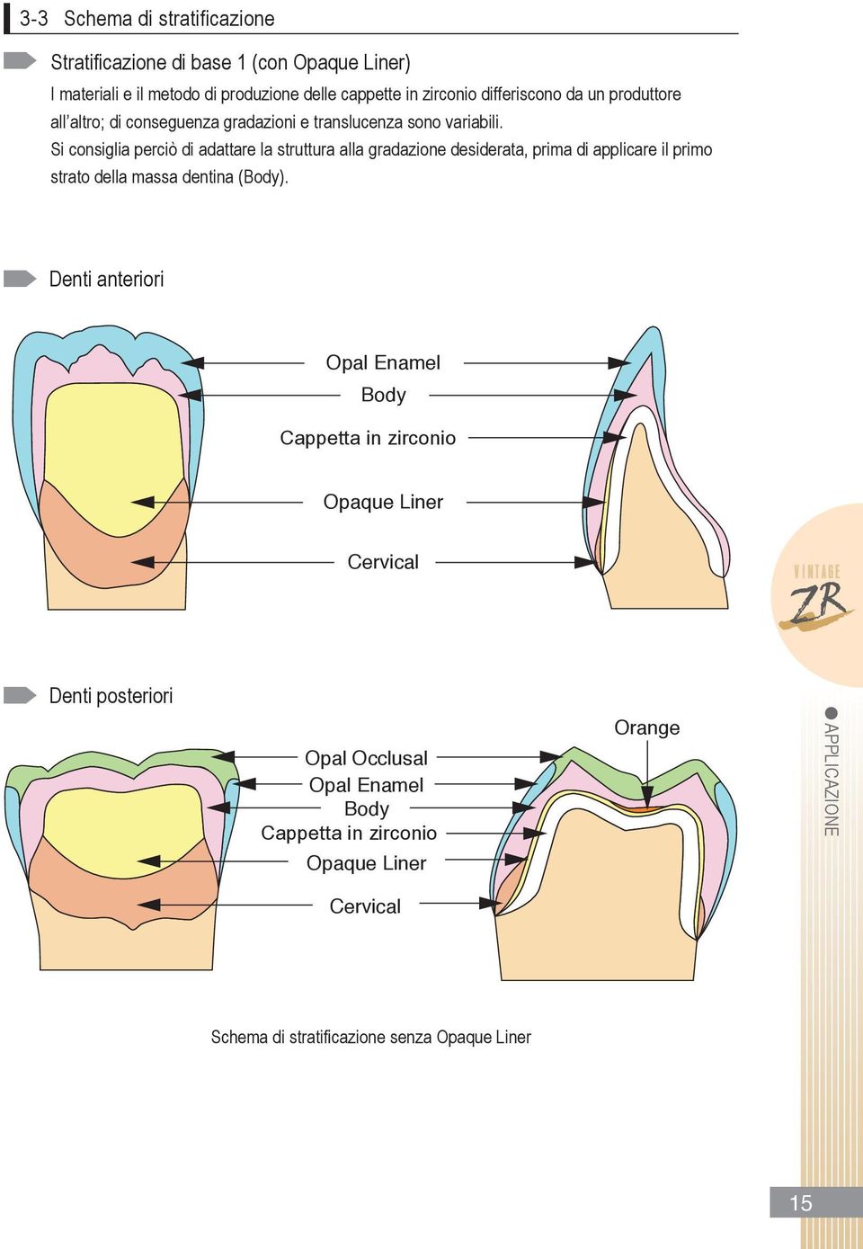 si consiglia perciò di adattare la struttura alla gradazione desiderata, prima di applicare il primo strato della massa dentina (Body).