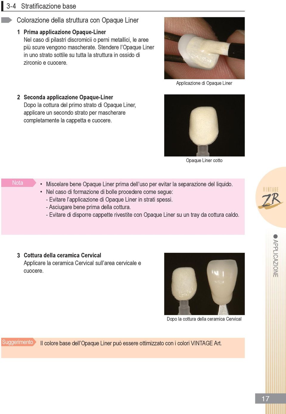 Auftragen der Approximalbereiche Applicazione di Opaque Liner 2 Seconda applicazione Opaque-Liner Dopo la cottura del primo strato di Opaque Liner, applicare un secondo strato per mascherare