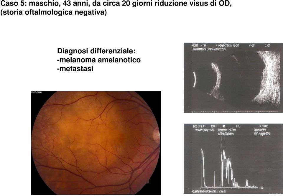 oftalmologica negativa) Diagnosi