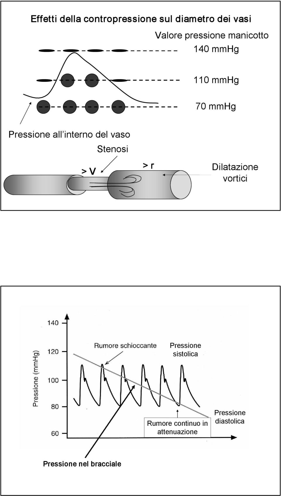 interno del vaso Stenosi > V > r Dilatazione vortici Pressione