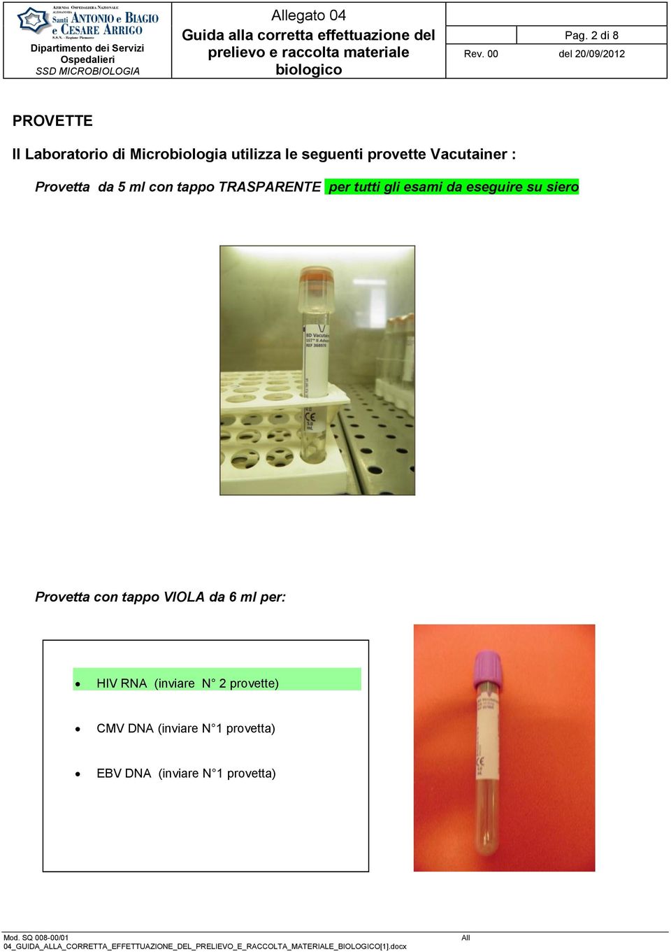 Vacutainer : Provetta da 5 ml con tappo TRASPARENTE per tutti gli esami da