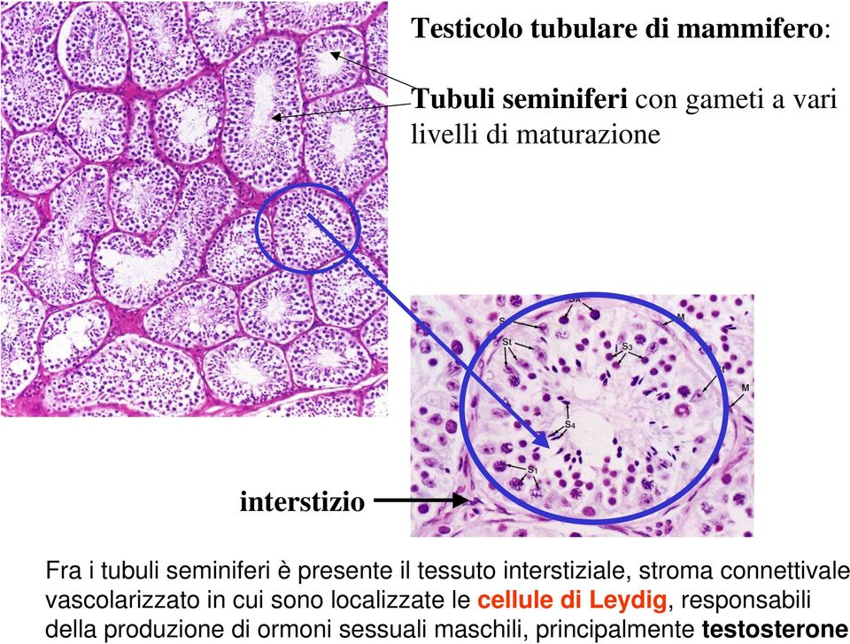 interstiziale, stroma connettivale vascolarizzato in cui sono localizzate le