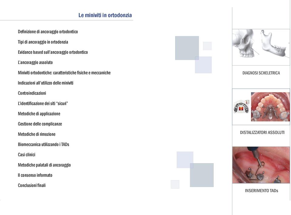 Controindicazioni L identificazione dei siti sicuri Metodiche di applicazione Gestione delle complicanze Metodiche di rimozione DISTALIZZATORI