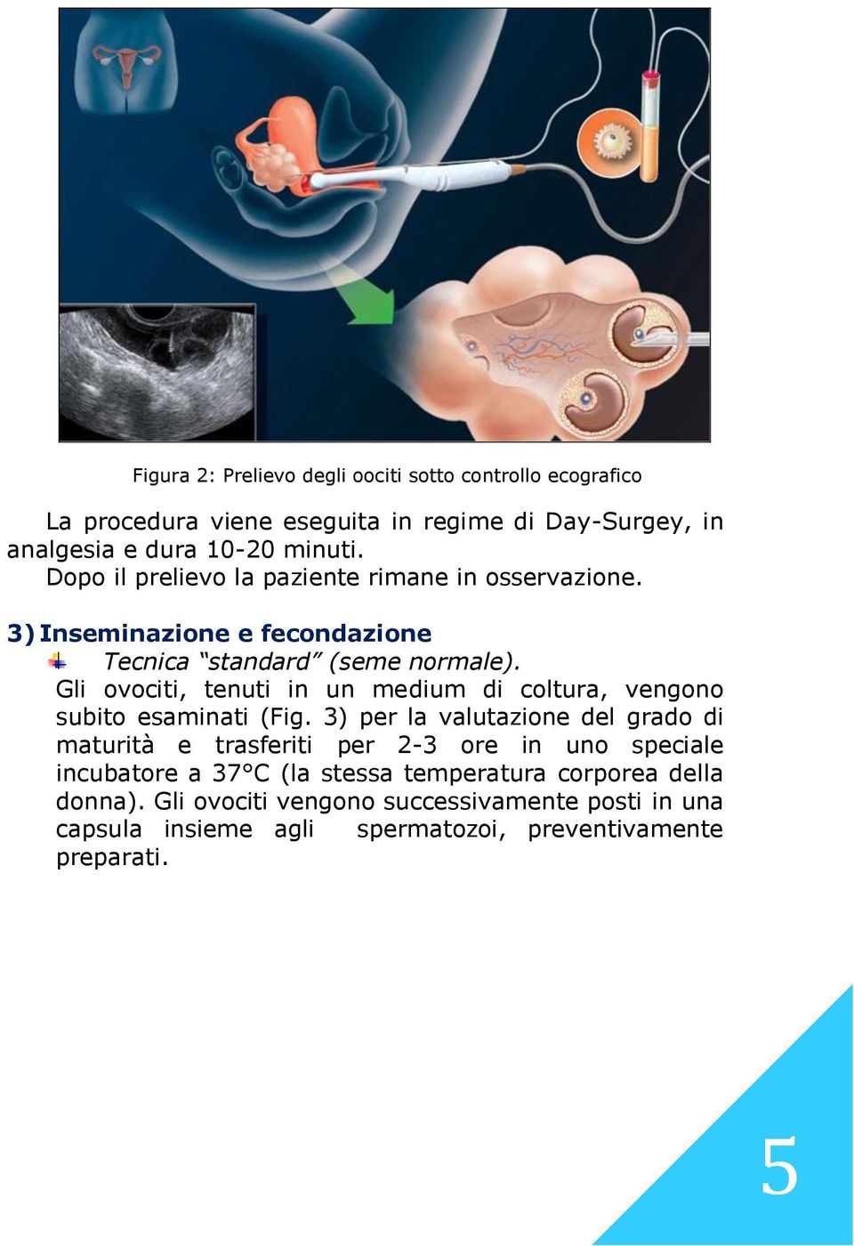 Gli ovociti, tenuti in un medium di coltura, vengono subito esaminati (Fig.