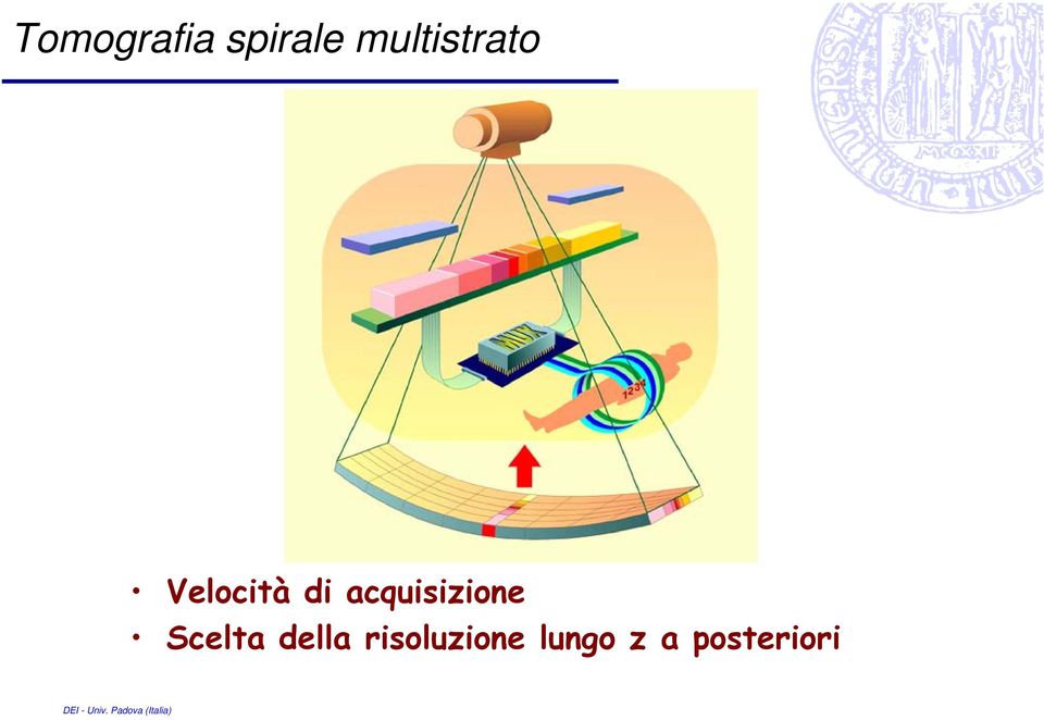 acquisizione Scelta della