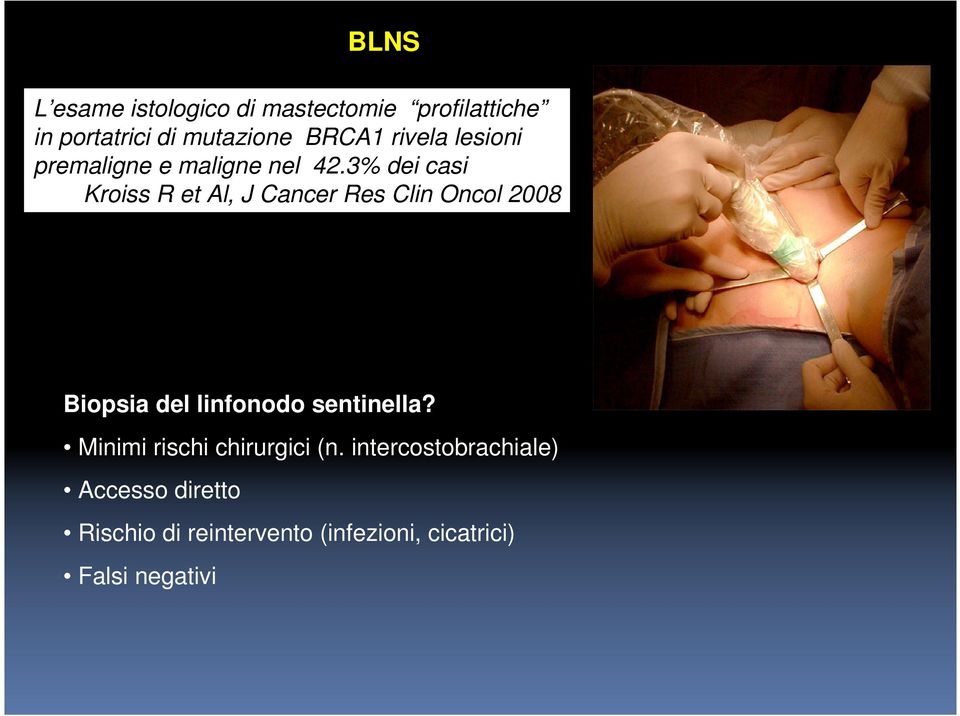 3% dei casi Kroiss R et Al, J Cancer Res Clin Oncol 2008 Biopsia del linfonodo