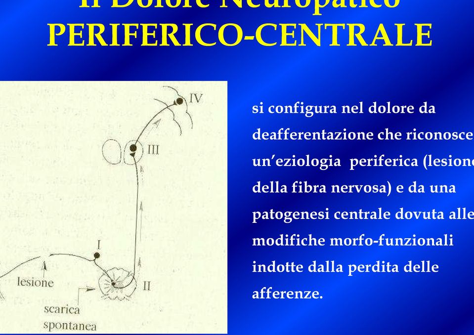 (lesione della fibra nervosa) e da una patogenesi centrale dovuta