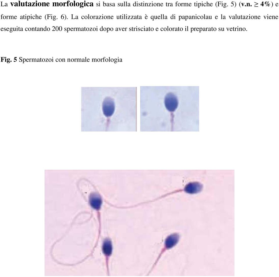 La colorazione utilizzata è quella di papanicolau e la valutazione viene