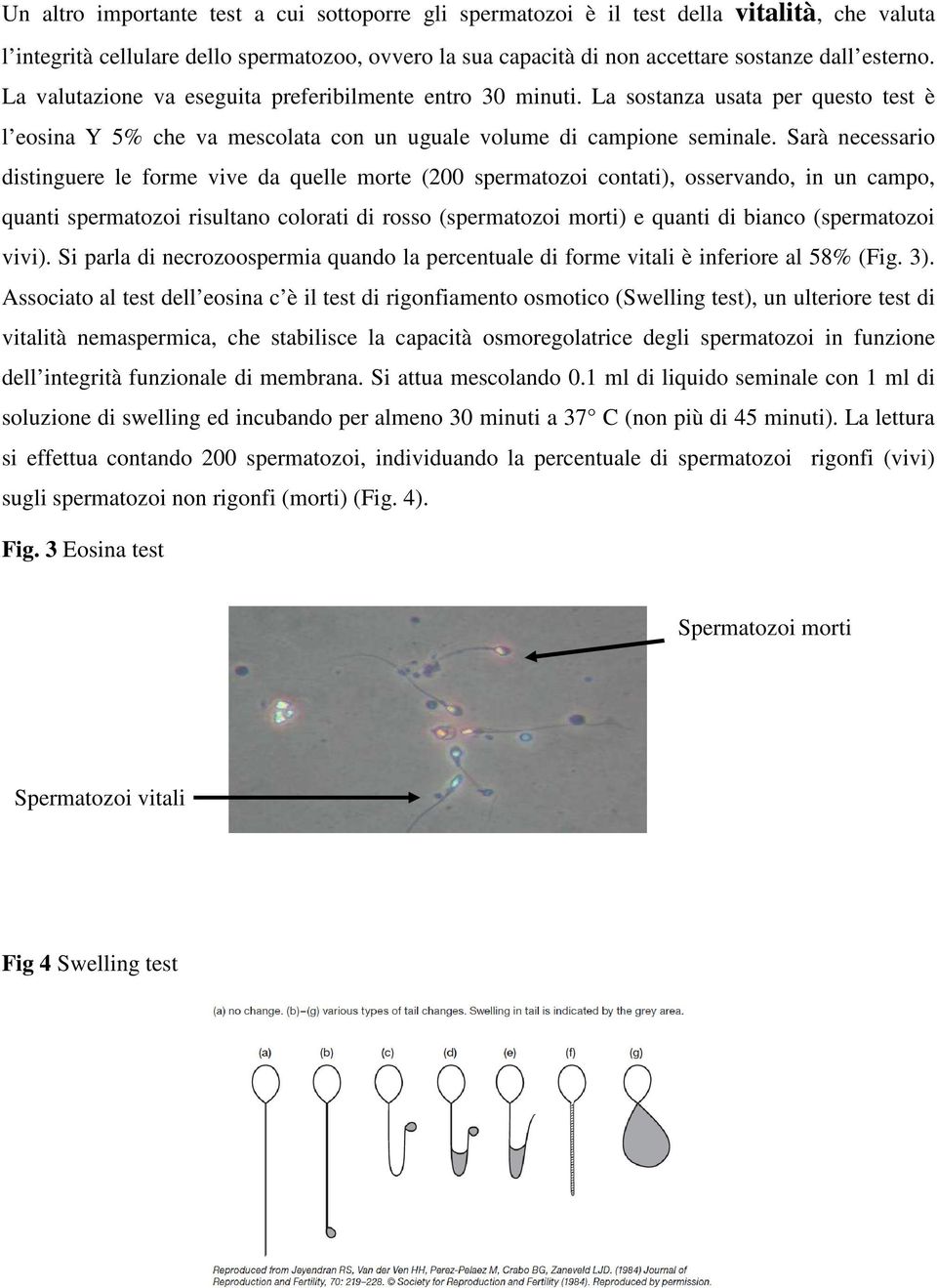 Sarà necessario distinguere le forme vive da quelle morte (200 spermatozoi contati), osservando, in un campo, quanti spermatozoi risultano colorati di rosso (spermatozoi morti) e quanti di bianco