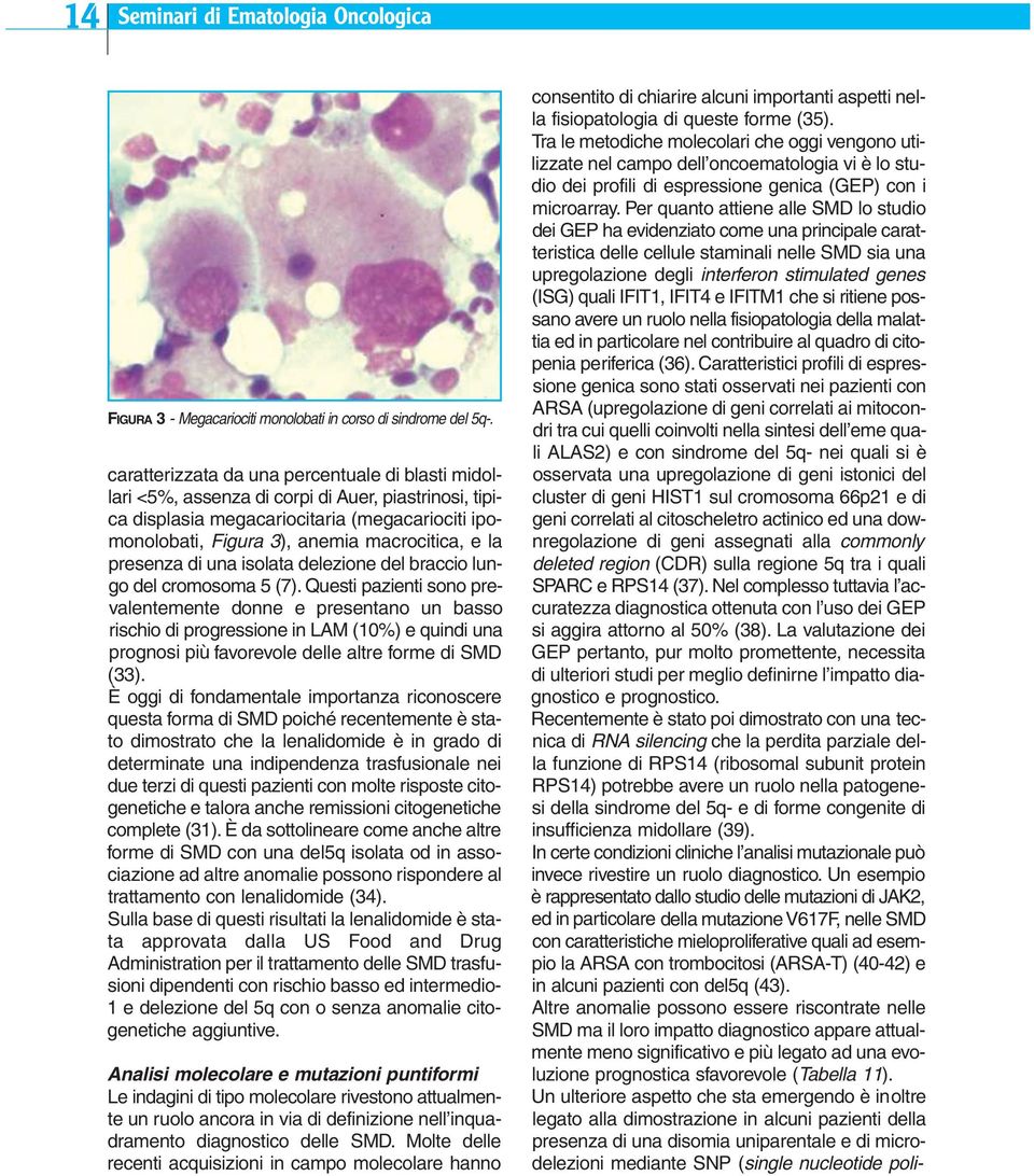 presenza di una isolata delezione del braccio lungo del cromosoma 5 (7).