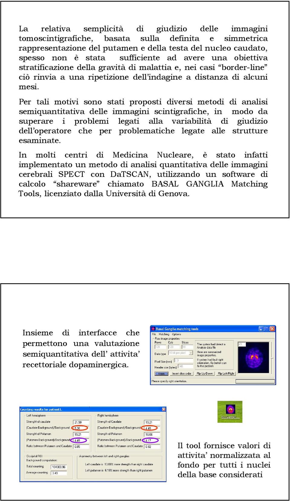 Per tali motivi sono stati proposti diversi metodi di analisi semiquantitativa delle immagini scintigrafiche, in modo da superare i problemi legati alla variabilità di giudizio dell operatore che per