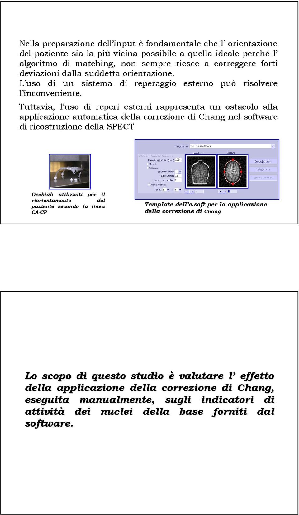 Tuttavia, l uso di reperi esterni rappresenta un ostacolo alla applicazione automatica della correzione di Chang nel software di ricostruzione della SPECT Occhiali utilizzati per il riorientamento