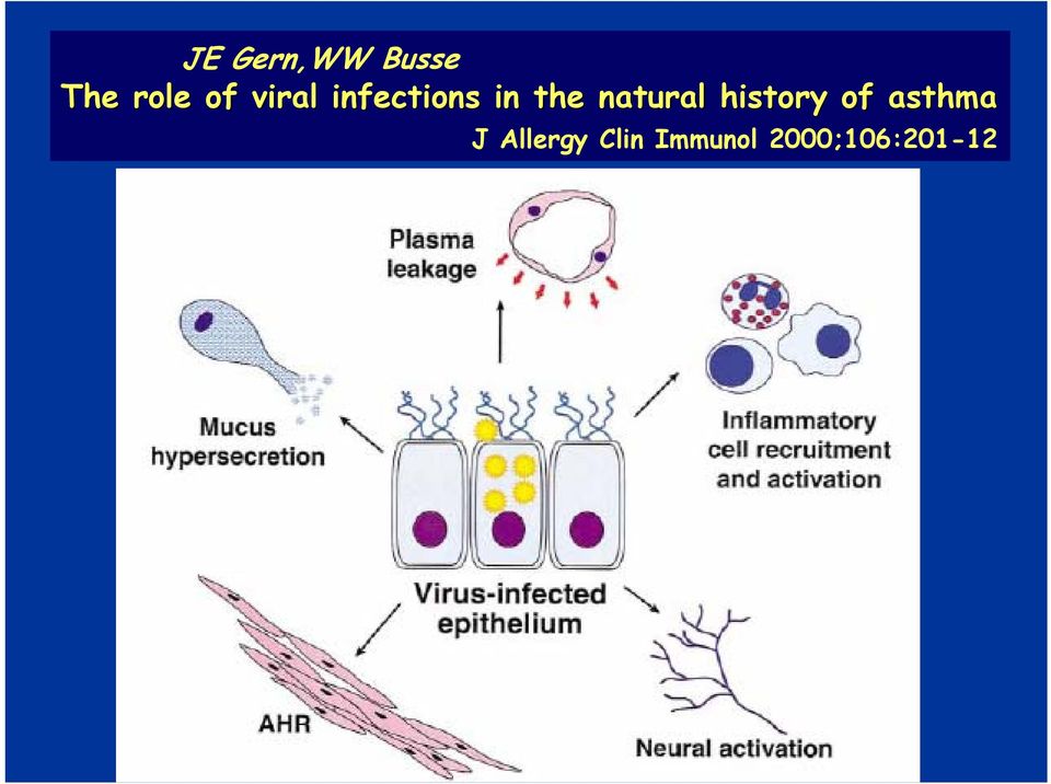 natural history of asthma J