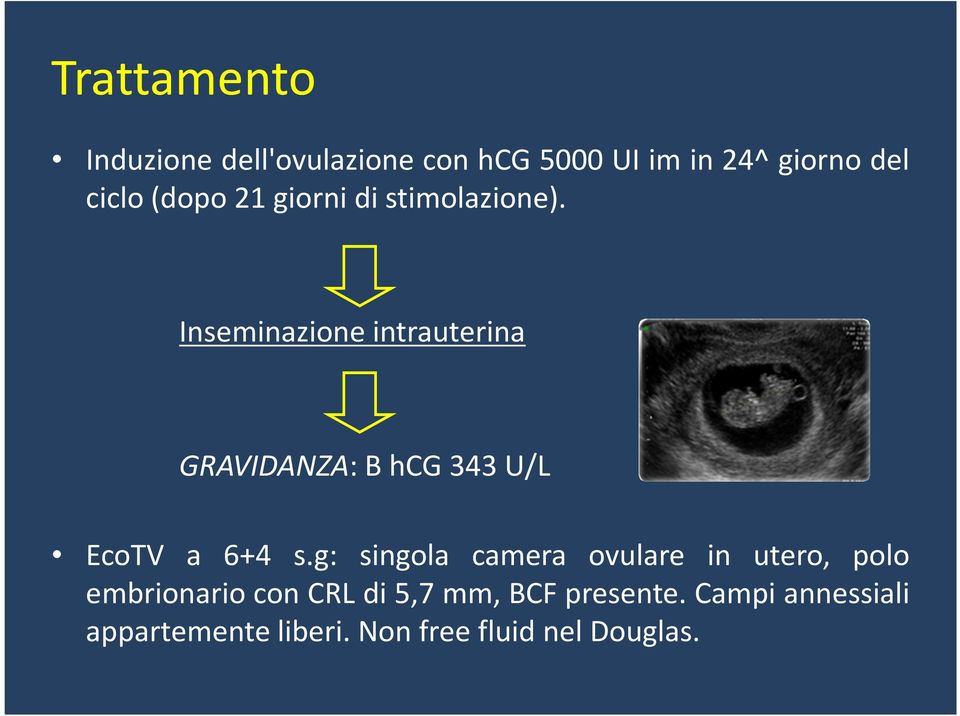 Inseminazione intrauterina GRAVIDANZA: B hcg 343 U/L EcoTV a 6+4 s.