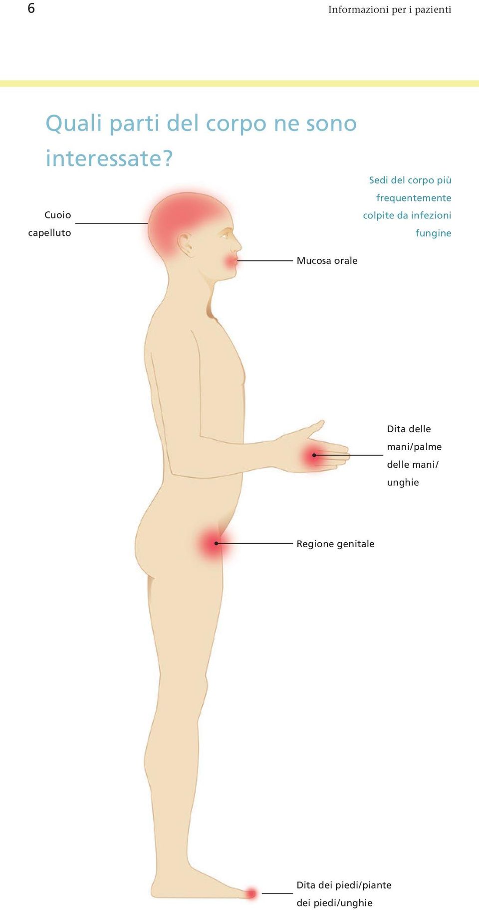 Sedi del corpo più frequentemente Cuoio colpite da infezioni