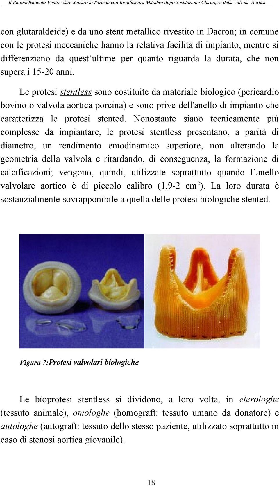 Le protesi stentless sono costituite da materiale biologico (pericardio bovino o valvola aortica porcina) e sono prive dell'anello di impianto che caratterizza le protesi stented.