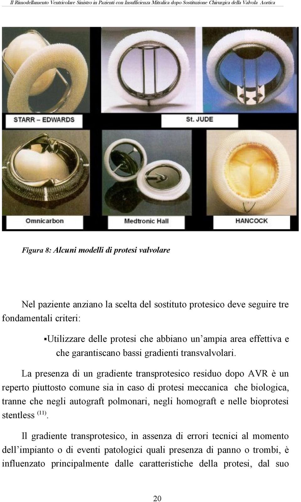 La presenza di un gradiente transprotesico residuo dopo AVR è un reperto piuttosto comune sia in caso di protesi meccanica che biologica, tranne che negli autograft