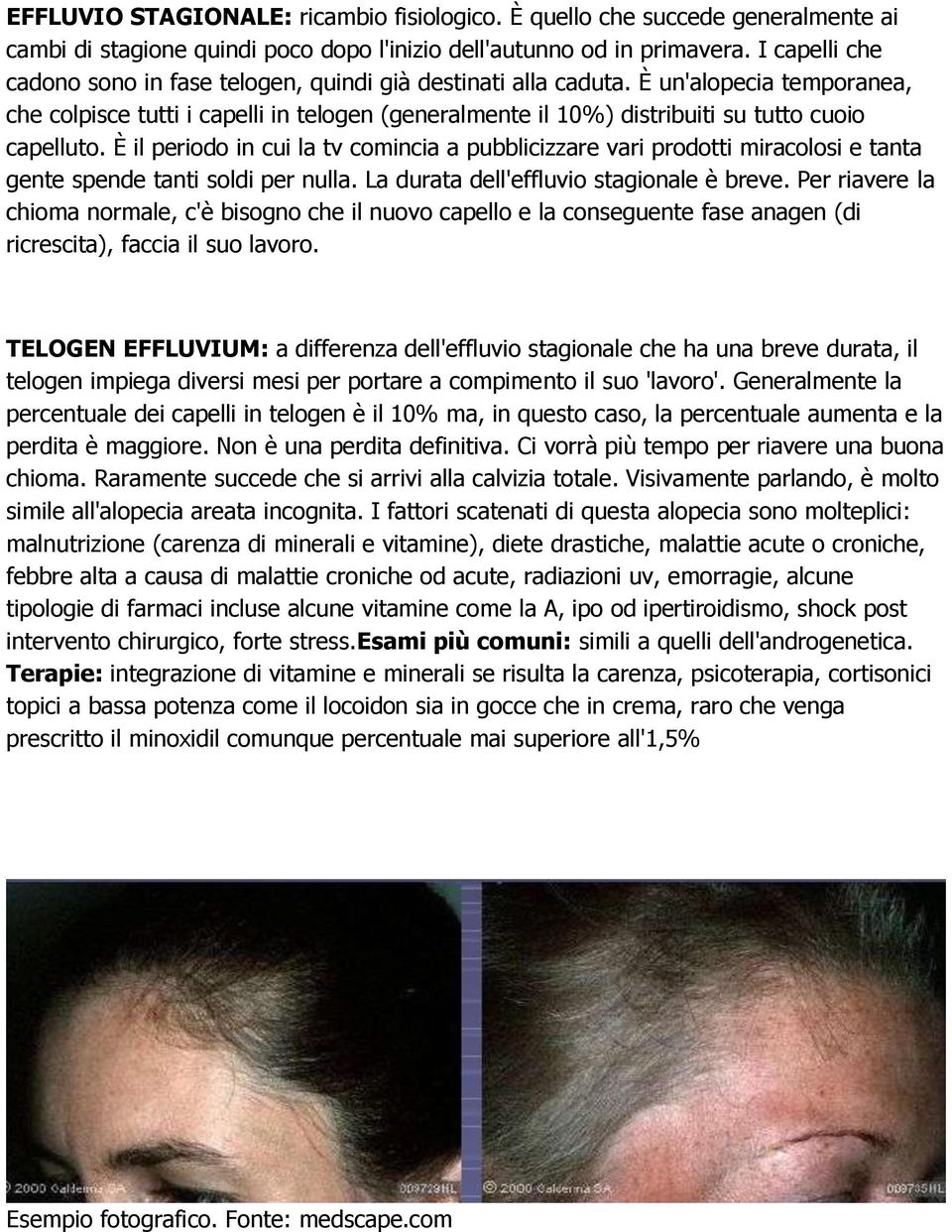 È un'alopecia temporanea, che colpisce tutti i capelli in telogen (generalmente il 10%) distribuiti su tutto cuoio capelluto.