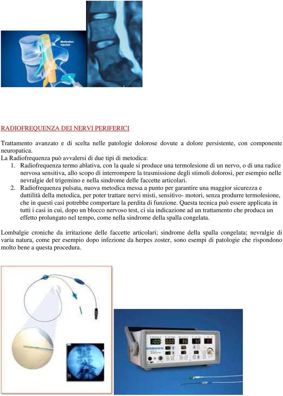 Radiofrequenza termo ablativa, con la quale si produce una termolesione di un nervo, o di una radice nervosa sensitiva, allo scopo di interrompere la trasmissione degli stimoli dolorosi, per esempio