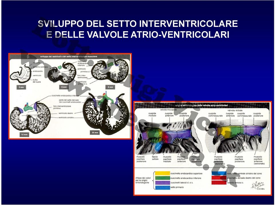 INTERVENTRICOLARE