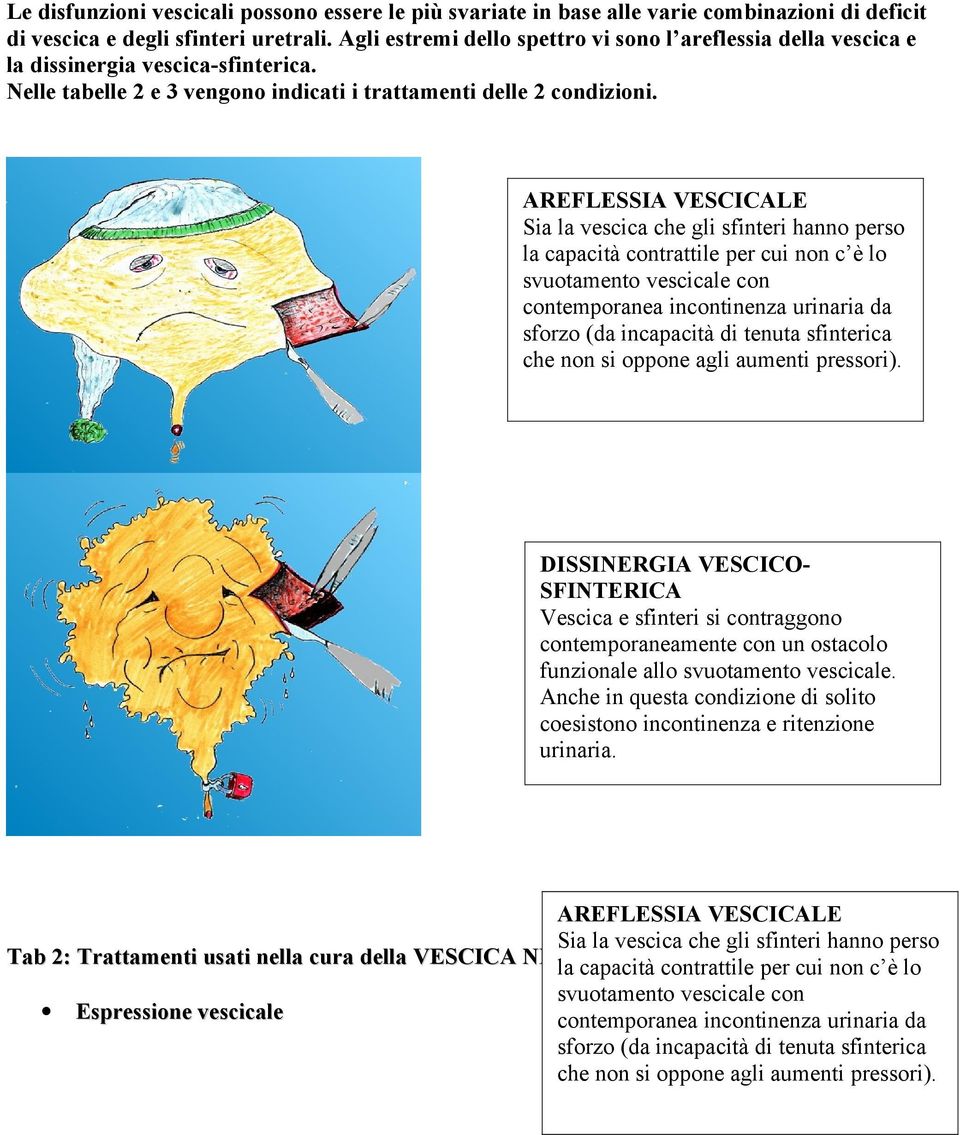 AREFLESSIA VESCICALE Sia la vescica che gli sfinteri hanno perso la capacità contrattile per cui non c è lo svuotamento vescicale con contemporanea incontinenza urinaria da sforzo (da incapacità di