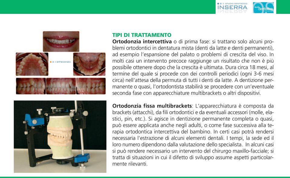 Dura circa 18 mesi, al termine del quale si procede con dei controlli periodici (ogni 3-6 mesi circa) nell attesa della permuta di tutti i denti da latte.