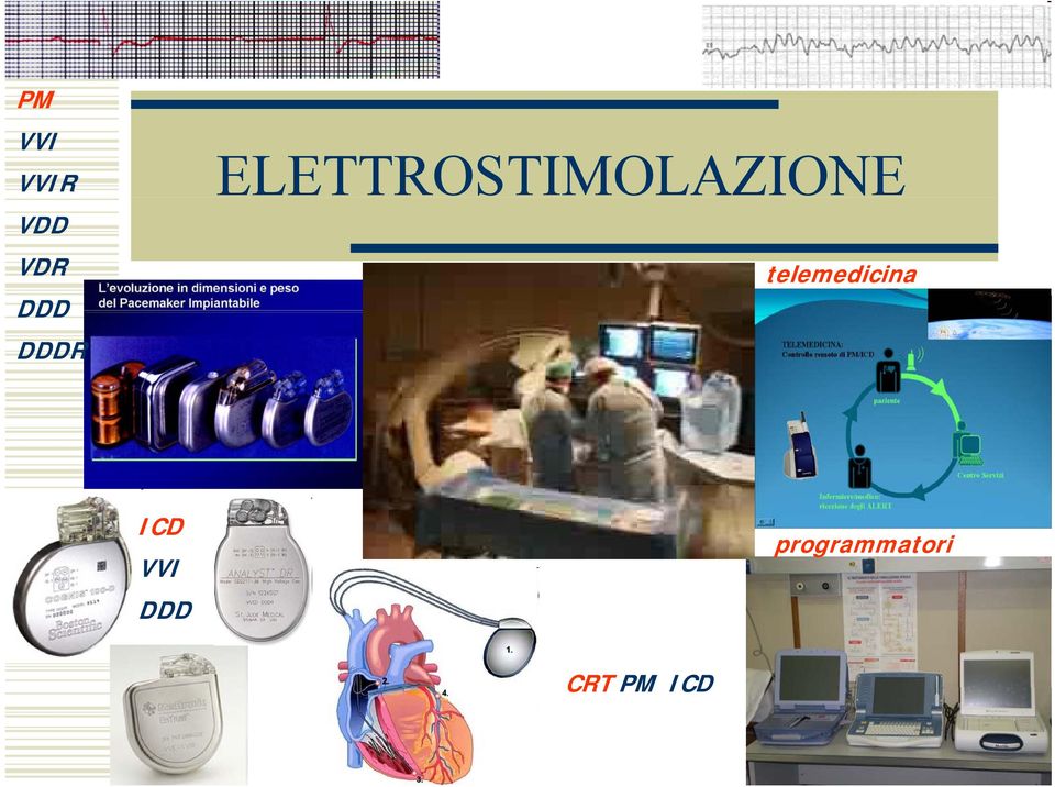 telemedicina ICD VVI DDD