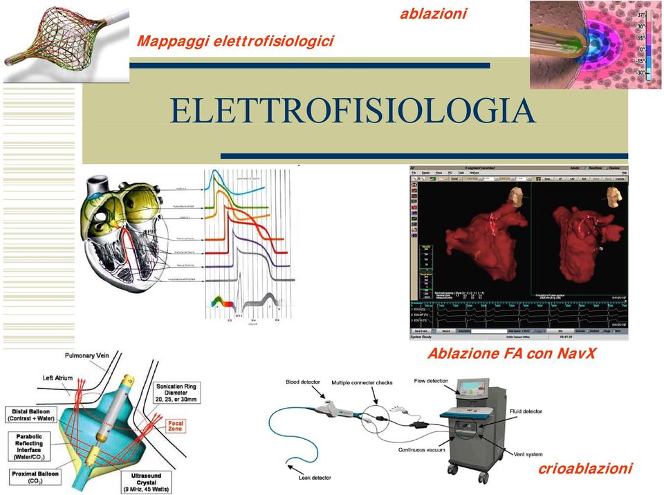 ELETTROFISIOLOGIA